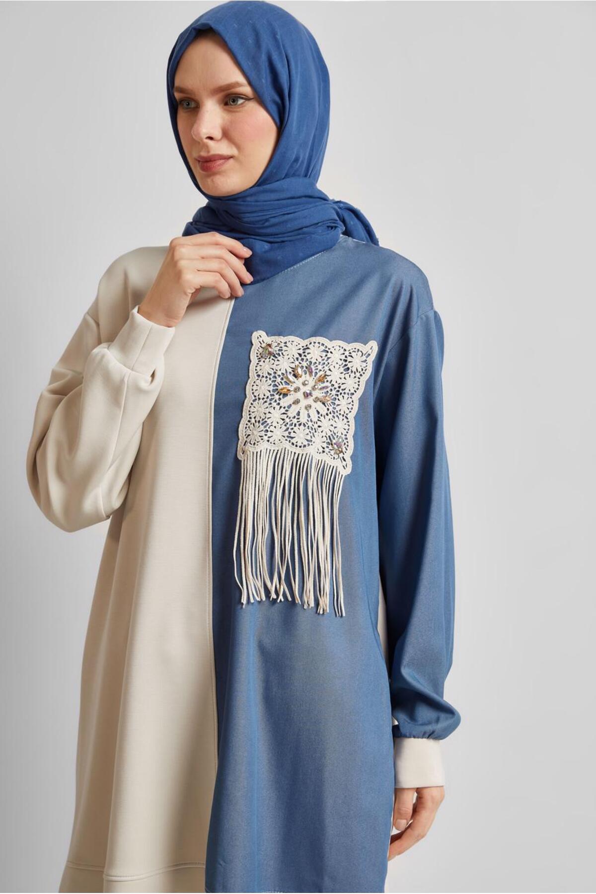 تونیک زنانه طرح دار آستین استاندارد | آلوینا Alvina 25YESF0045569